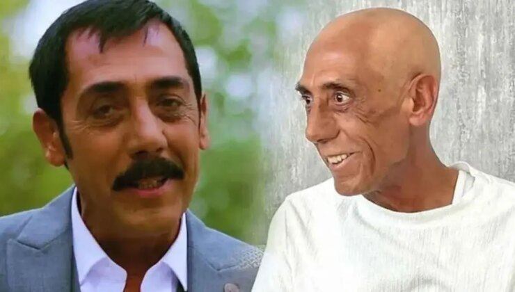 Ankaralı Turgut’tan müjdeli haber: Birinci kez gözlerini kırptı